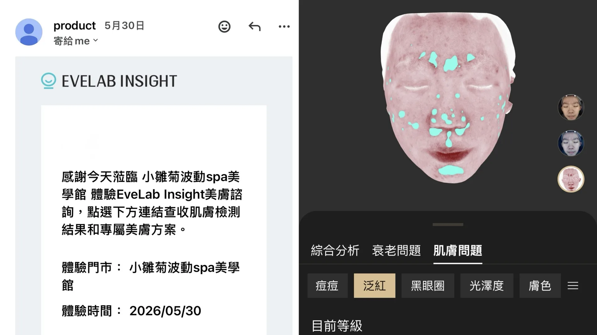 台北中山區做臉推薦｜客製肌膚管理